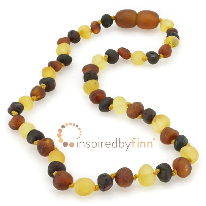 Raw Baltic Amber Necklace – Variation inspired by finn Lil Tulips